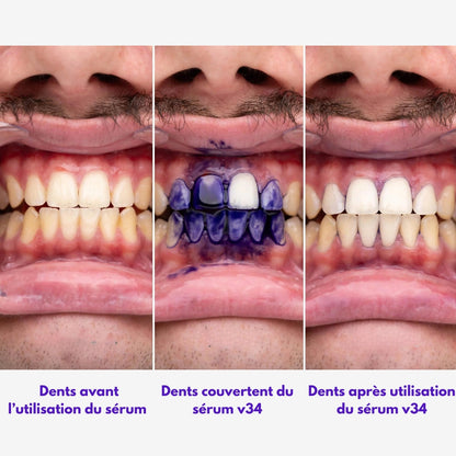 Sérum Correcteur de Couleur